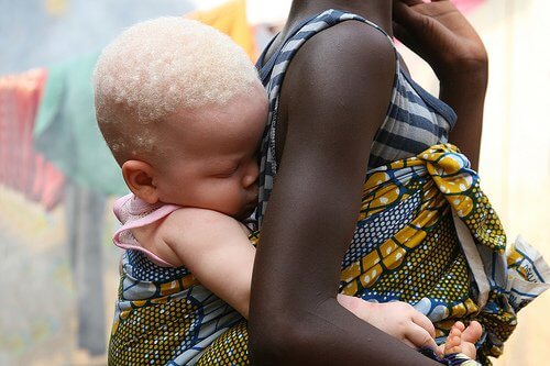 albinobarn på morens rygg