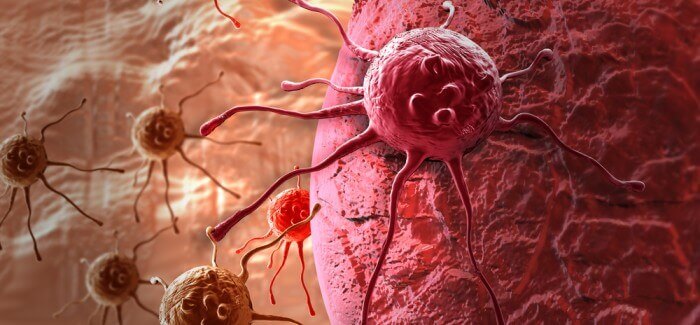 Possible Signs of Cancer in Men and Women