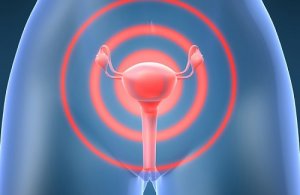 How to Reduce the Risks of Cervical Cancer