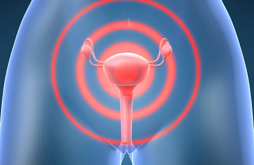 How to Fight Cervical Cancer How to Fight Cervical Cancer