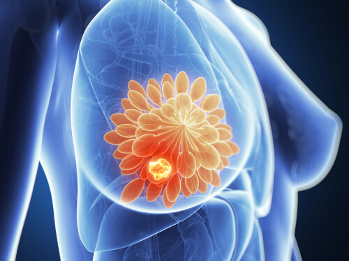 Möjliga tecken på cancer hos män och kvinnor