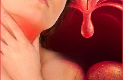 Remedies-to-treat-pharyngitis-500x325