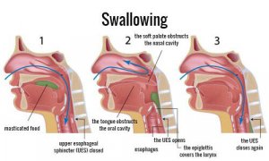 What to Do When Someone is Choking