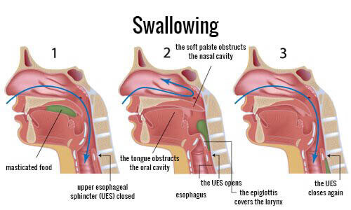 What to Do When Someone is Choking