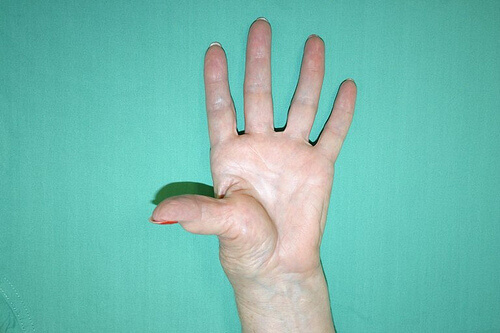 Flexibel tumme