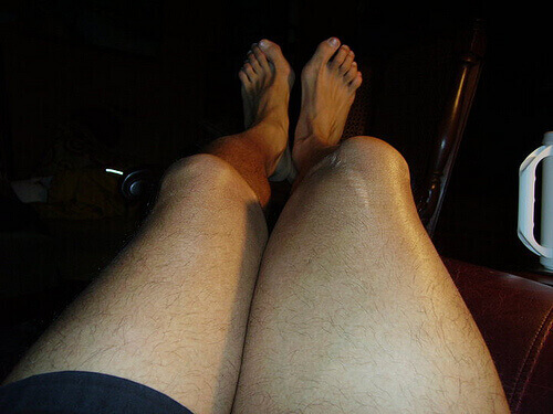 Kan man behandla ledslitage?