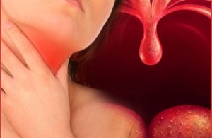 Homemade Natural Remedies for Pharyngitis