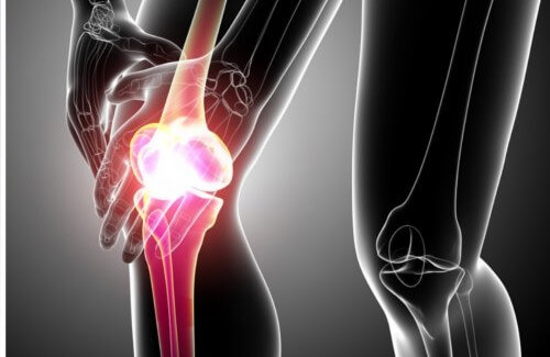 How to Ease Tendonitis Symptoms Naturally