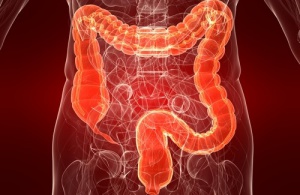 Irritable Bowel Syndrome: IBS Symptoms in Women