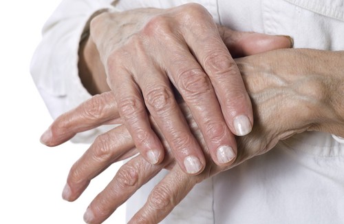 Natural Remedies for Chapped and Dry Hands