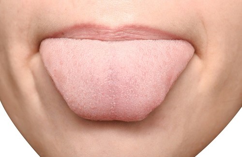 The Meaning of the Marks on Your Tongue The Meaning of the Marks on Your Tongue