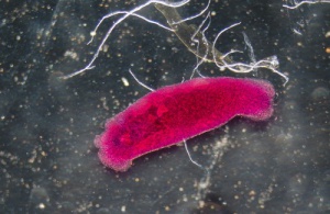 Natural Remedies that May Help Eliminate Parasites