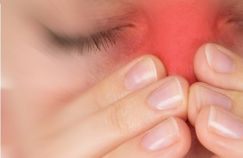 5 Natural Remedies for Sinus Infections