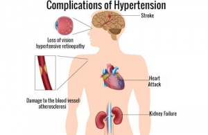 The Best Ways to Fight High Blood Pressure