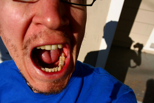 toothache