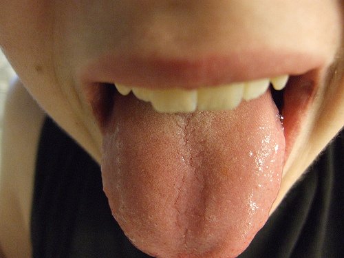 Person viser sin tunges udseende