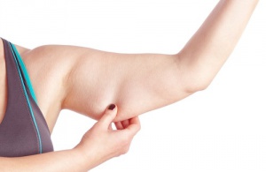 Remedies and Exercises to Correct Arm Flaccidity