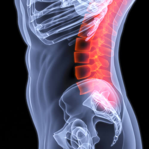 X-ray showing area of back pain