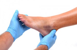 The Causes of Swollen Ankles and Feet
