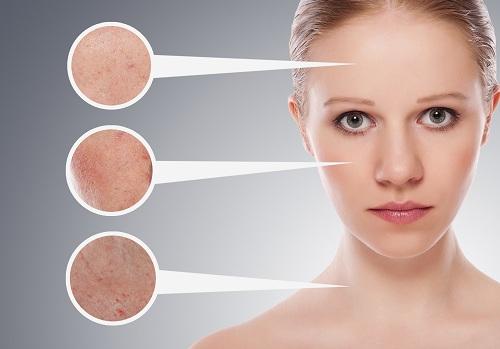 woman with different skin problems