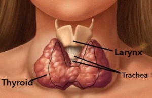 Natural Ways to Help Treat Hypothyroidism
