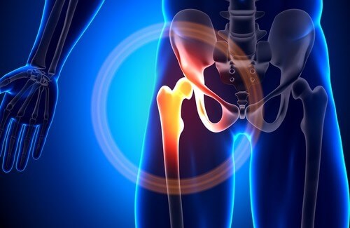 What to Do for Calcium Deficiency What to Do for Calcium Deficiency