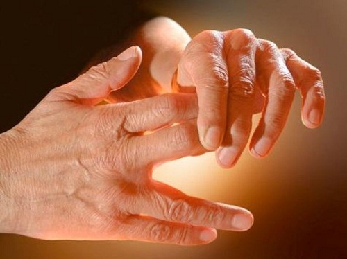 Causes of Tingling in Hands and Feet