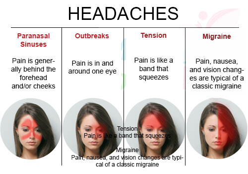 Types of headaches.