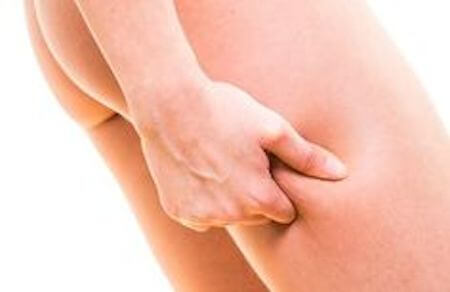 How to Fight Cellulite How to Fight Cellulite
