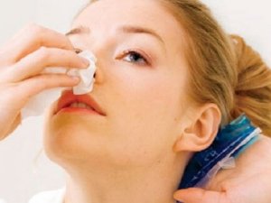 What to Do When Your Nose Bleeds