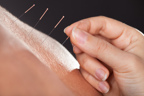 Dealing with knee pain is one of the most common issues for people seeking acupuncture