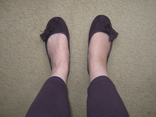 A woman with one swollen ankle.