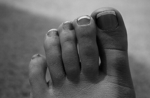 Close up of foot