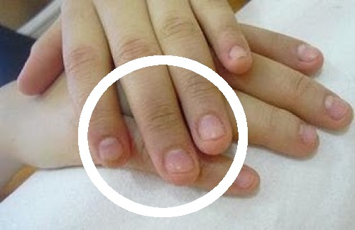 10 Tips to Stop Biting Your Nails