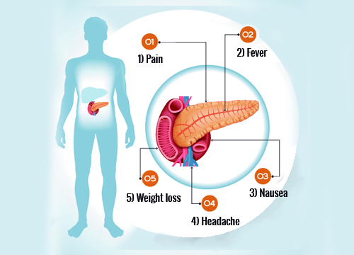 6 Symptoms of Pancreas Problems 6 Symptoms of Pancreas Problems
