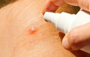The Best Homemade Mosquito Repellents