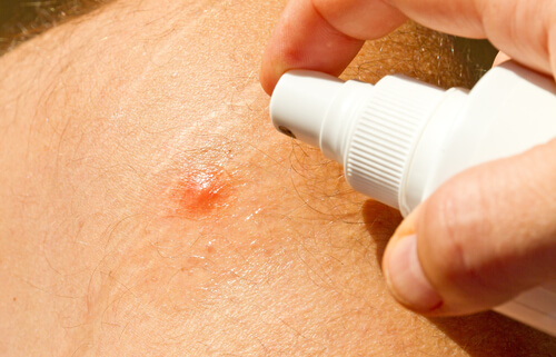 The Best Homemade Mosquito Repellents