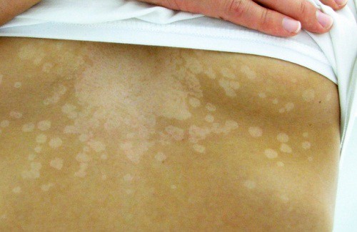 5 Ways Skin Conditions Can Tell You Something Is Wrong