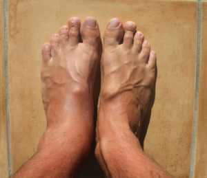 How to Reduce Ankle Swelling
