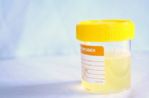 Homemade Remedies for Urinary Infections