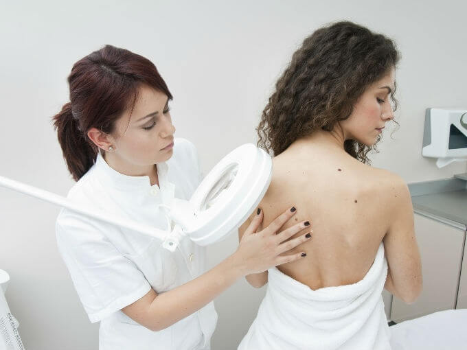 diagnosing cherry angioma