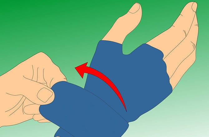 Compression gloves for swollen fingers