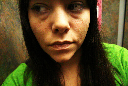 A woman with some eye bags.