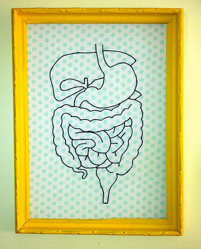 Diverticulosis can be an uncomfortable and dangerous condition