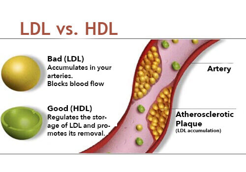Consuming too much cholesterol is one of the habits that damage your liver