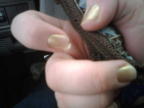 Broken nails with gold nail polish nails peel 