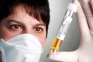 What the Color of Your Urine Says About Your Health