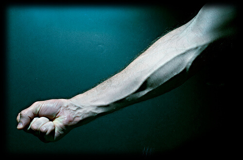 Artery5