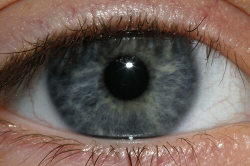 https://steptohealth.com/wp-content/uploads/2015/04/blue-eye-Jenn-Durfey.jpg