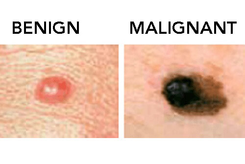 Some Facts About Moles